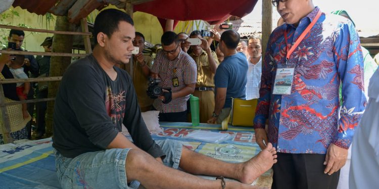 Plt Gubernur Aceh Lepas Pasung Jamil Khairi